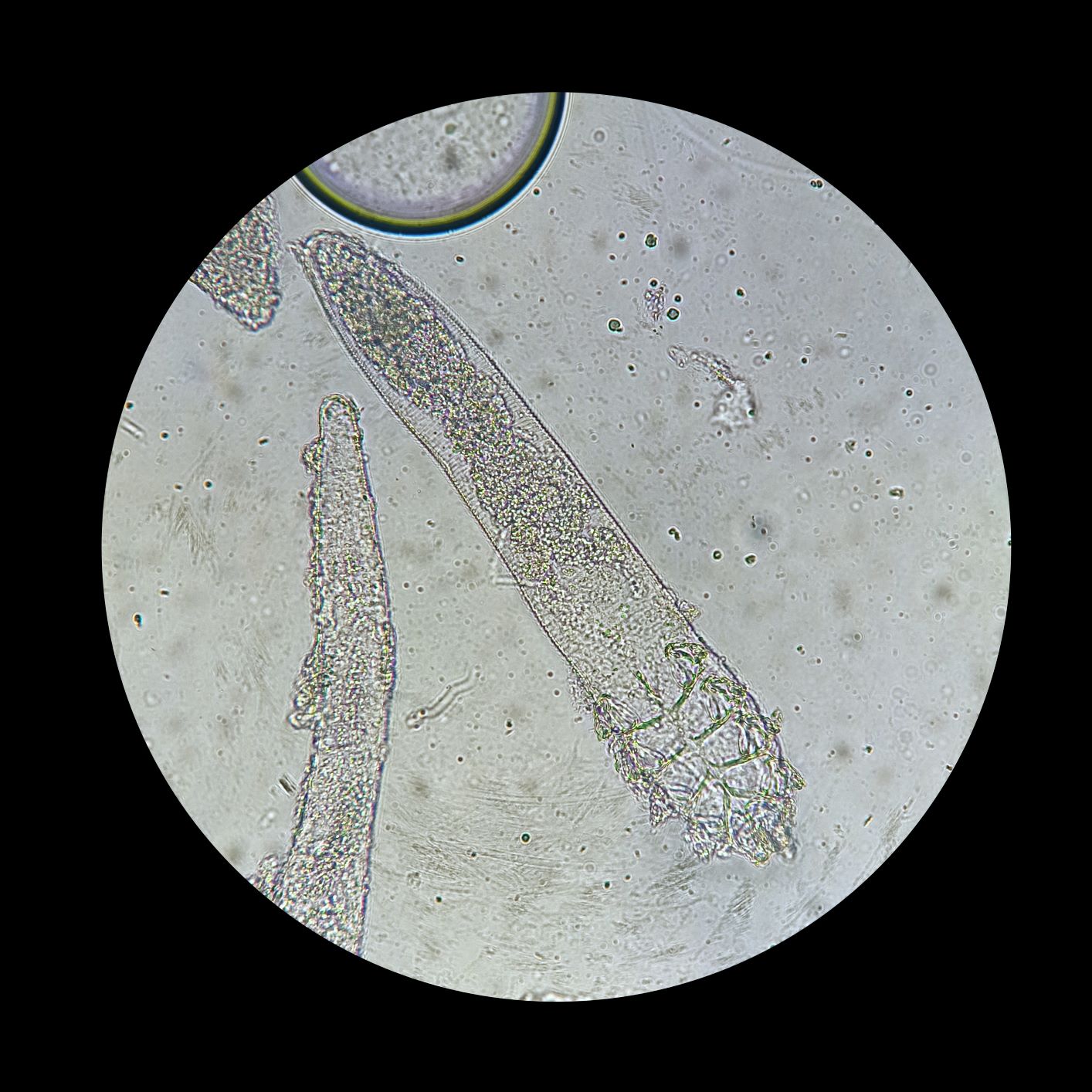 Demodex mites under a microscope