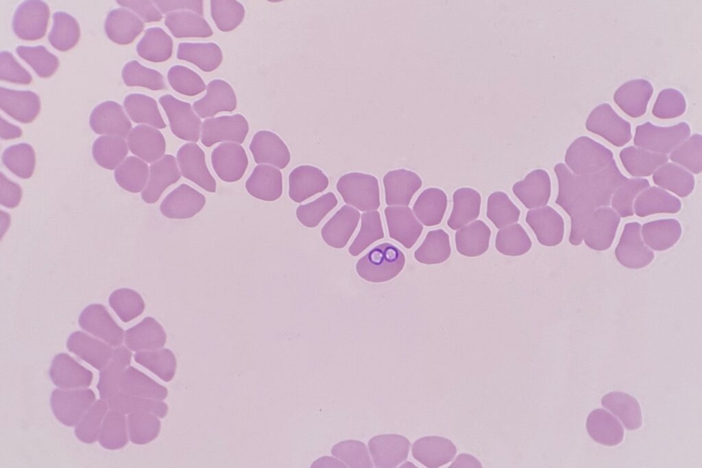 Babesia parasites inside red blood cell